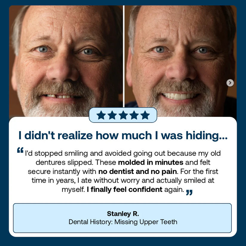 2026 Hot Sale Ends Today: 70% OFF! Custom Custom-Fit Full Functional DenturesMake you more confident – Made in the USA