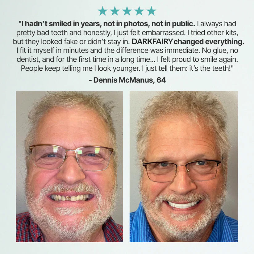 -DarkFairy™ Custom-Fit Dentures — Designed for Comfort and a Natural-Looking Smile