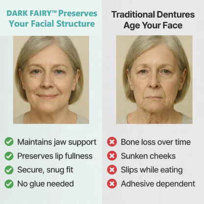 2026 Hot Sale Ends Today: 70% OFF!  Custom Custom-Fit Full Functional DenturesMake you more confident – Made in the USA