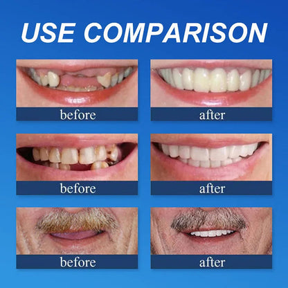 2026 Hot Sale Ends Today: 70% OFF!  Custom Custom-Fit Full Functional DenturesMake you more confident – Made in the USA
