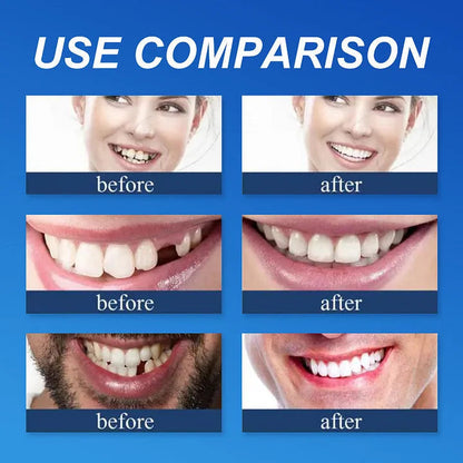 2026 Hot Sale Ends Today: 70% OFF!  Custom Custom-Fit Full Functional DenturesMake you more confident – Made in the USA